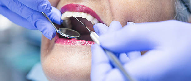 Best Emergency Dental Care for Broken or Chipped Teeth in Martinez, GA